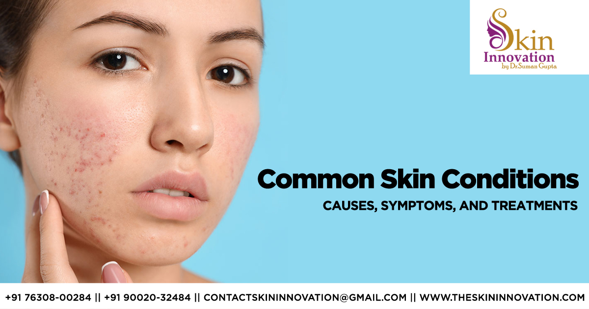 common-skin-conditions